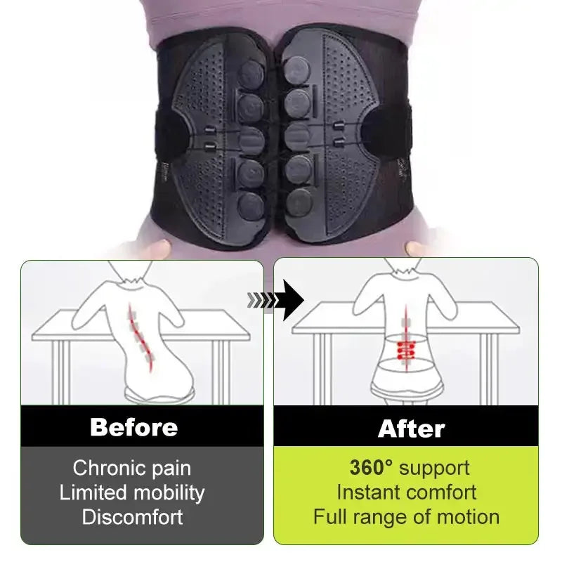 Adjustable Lumbar Support Belt Double Pull Pulley Breathable Body Shaping Waist Support Fixation Belt for Lower Back Pain Relief
